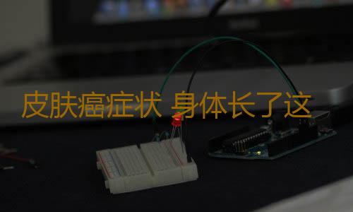 皮肤癌症状 身体长了这种不明物竟暗示皮肤癌